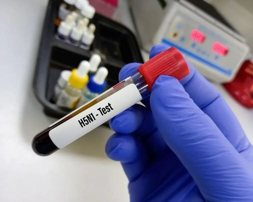 Dünyada panik yaratan haber: Kuş gribi mutasyona uğradı! Daha ölümcül ve bulaşıcı... - Resim: 3