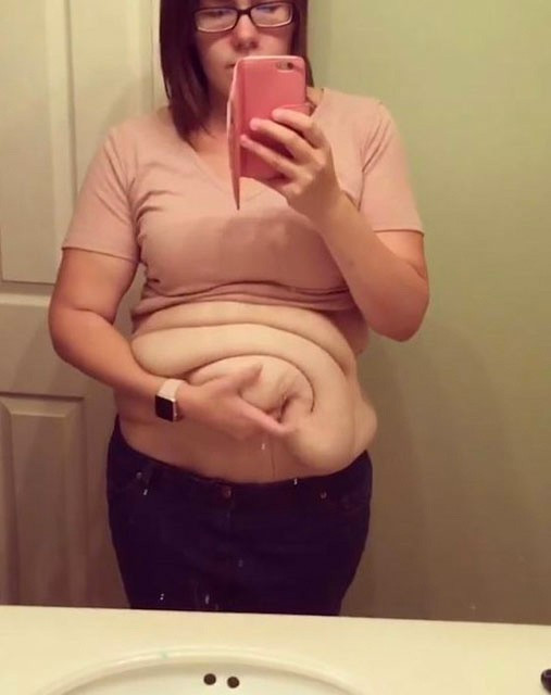 64 kilo verdi ama görenler inanmıyor bakın neden - Resim: 4