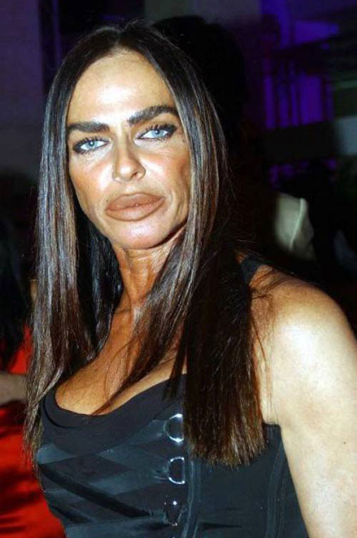 Estetik sonrası faciaya dönüştüler - Resim: 2