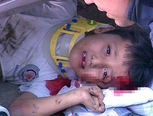 Bisikletiyle otomobilin altında kaldı - Resim: 3