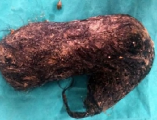 Hamileyim diye doktora gitti karnından çıkanlar şoke etti - Resim: 3