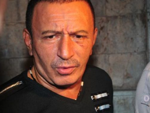 İşte botokslu Mustafa Topaloğlu - Resim: 1