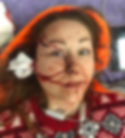 Boşanmak istediği kocası yüzünü falçata ile kesti! Anna Butim'i hala ölümle tehdit ediyor - Resim: 2