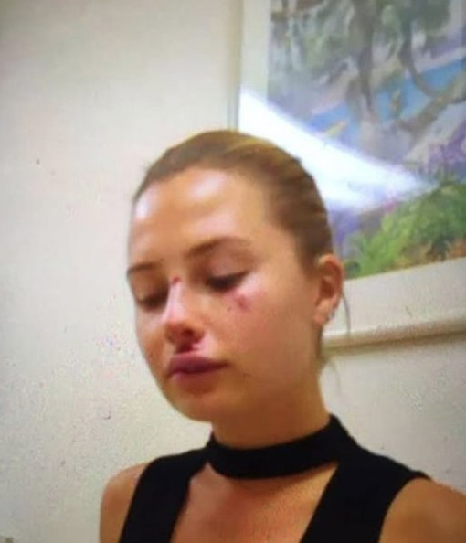 Serdar Ortaç'la Chloe Loughnan'ın boşanma nedeni Merve Şentürk mü? - Resim: 2