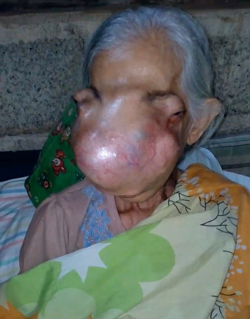 Yaşlı kadın iki yıl içerisinde bu hale geldi gören kaçıyor ama... - Resim: 3