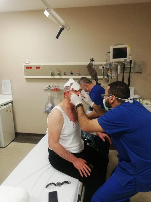 Gelecek Partili Selçuk Özdağ saldırı anını anlattı! 5 kişiydiler, yüzleri açıktı sopalarla vurup silah çektiler - Resim: 2