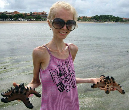 Görüntüsüyle dehşete düşürdü - Resim: 4