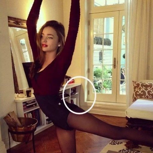 Güzelleşeceğim derken rezil olanlar - Resim: 2