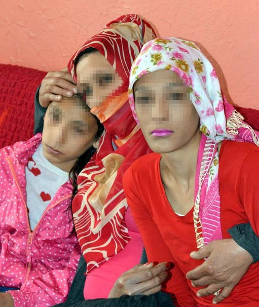 Çift cinsiyetli kardeşlerin dramı! Kaynanası öğrenince... - Resim: 1