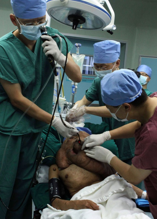 Dünyanın en büyük tümörü - Resim: 4