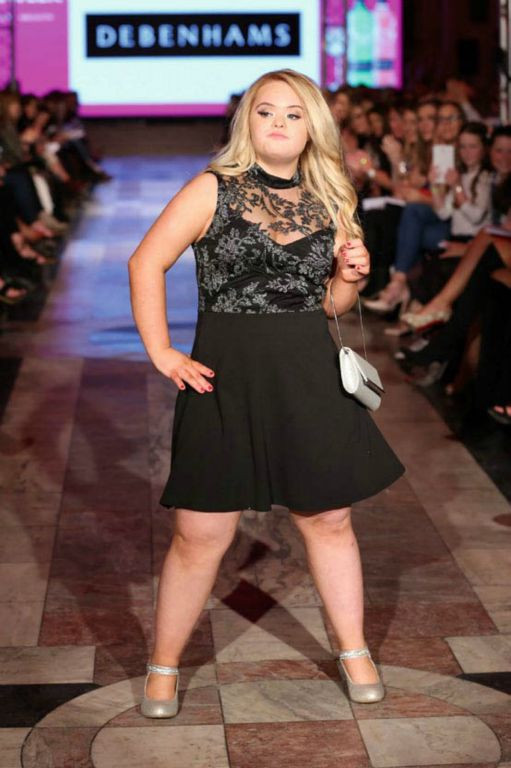 Down sendromlu model  güzellik yarışmasını kazandı - Resim: 3