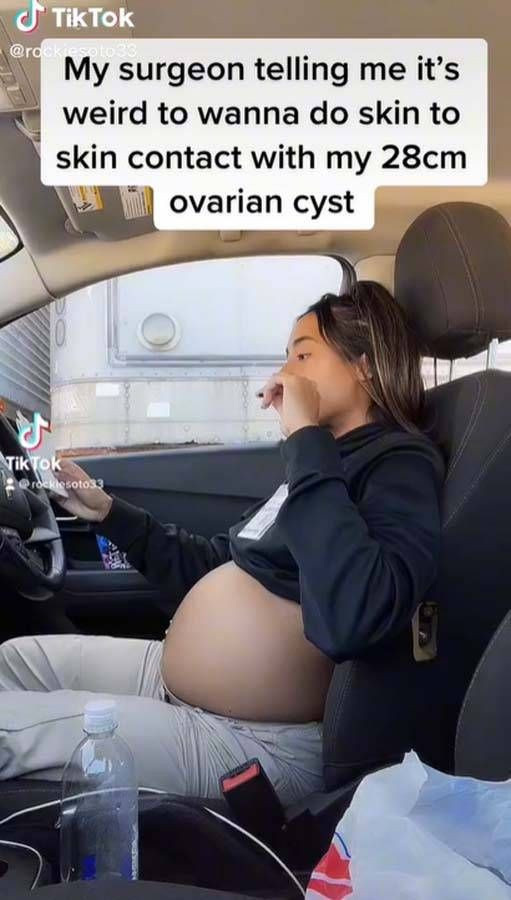 Karnı hamile gibi şişmeye başlayan kadın gerçeği öğrenince şok geçirdi! - Resim: 2