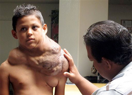 Dev tümör çocuğu bu hale getirdi - Resim: 1