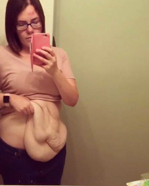 64 kilo verdi ama görenler inanmıyor bakın neden - Resim: 1