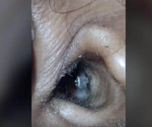 Kulaklarından öyle şeyler çıktı ki görenler hayret etti - Resim: 3