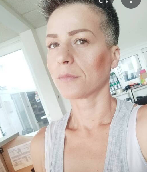 Survivor yarışmacısı Acun Ilıcalı'ya 3,5 milyonluk dava açtı ''Beni sakatken oynamaya zorladı'' - Resim: 4