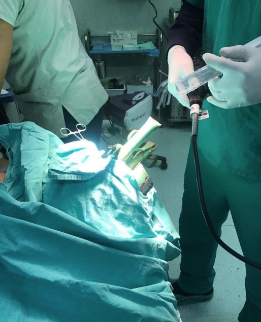 Gencin yüzüne saplanan çubuk için hastanedeki operasyona itfaiye ekibi de dahil oldu - Resim: 4