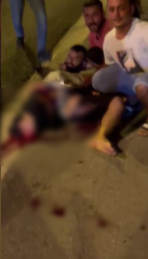 Adana'da korkunç olay! Merakı yüzünden sağ bacağından oldu - Resim: 2