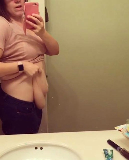 64 kilo verdi ama görenler inanmıyor bakın neden - Resim: 3