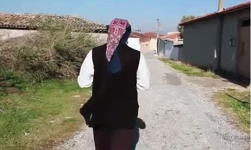 O hem kadın hem de erkek! Hikayesi çok ilginç - Resim: 3