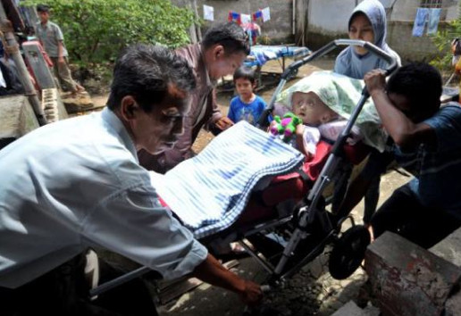 Bu çocuğun kafası sürekli büyüyor - Resim: 3