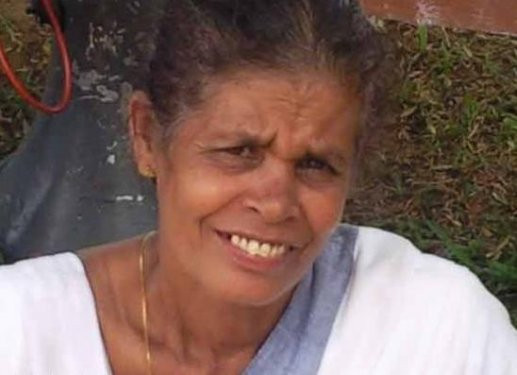 Et yiyen virüs kadının yüzünü yedi - Resim: 1