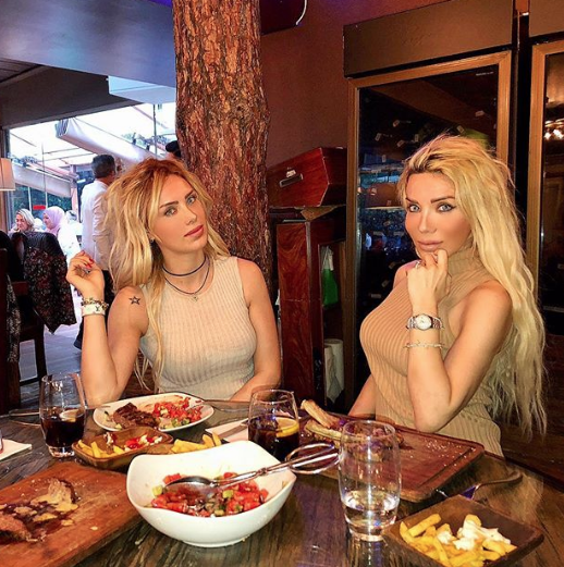 Ciciş kardeşlerden Esra Ersoy'un son hali görenleri şaşırttı - Resim: 1