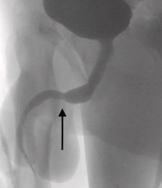 Cinsel organını ölçmek için yaptığı şey herkesi şaşkına uğrattı! Cinsel organına öyle bir şey soktu ki doktorlar bile çaresiz kaldı - Resim: 1