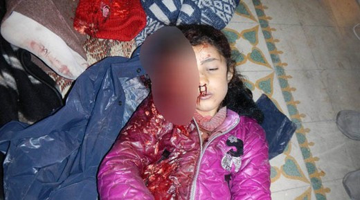 Suriye'deki katliamın fotoğrafları - Resim: 3