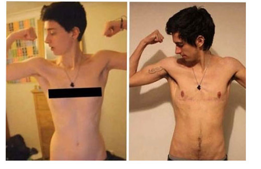 Jamie Raines inanılmaz değişimi