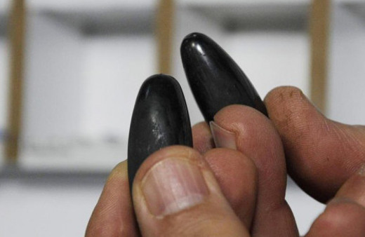 Çocukların midesinden çıkanlar şok etti