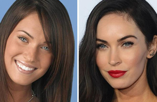 Gösteri dünyasının en ünlü estetikleri