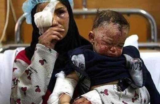 Rus uçakları Türkmenler'i vuruyor!