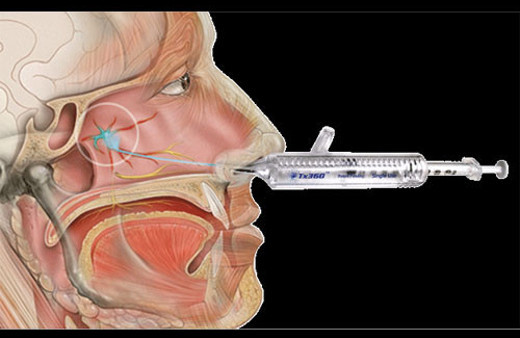 Migren ameliyatı nasıl yapılır? Ameliyat öncesi hasta neler yapmalı? 