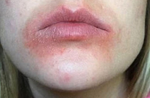 Ünlülerin dudak kremine büyük dava!