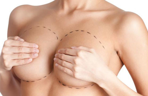 Meme büyütme ameliyatı