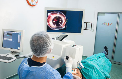 Femtosaniye lazerle katarakt ameliyatı nedir?