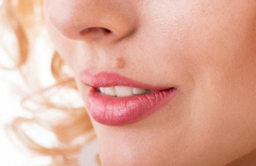 Et benleriniz varsa dikkat!