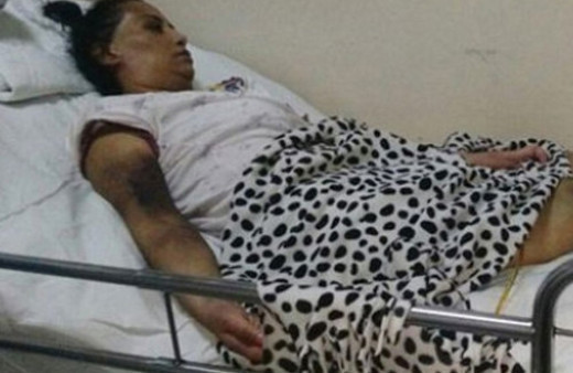 Mide küçültme ameliyatı hayatını kararttı!