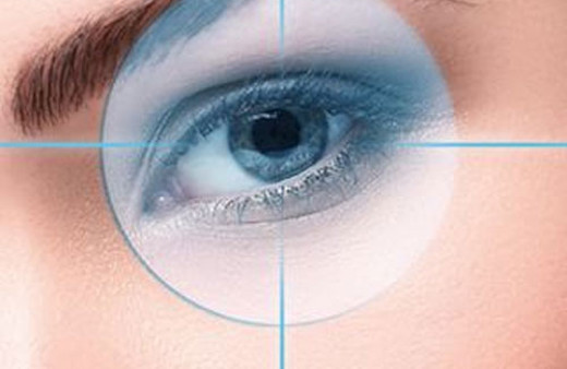 'Smile lazer ' neden tercih edilen bir yöntem olmalıdır?