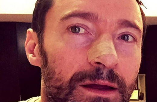 'Tedbir almazsanız benim gibi kanser olursunuz'