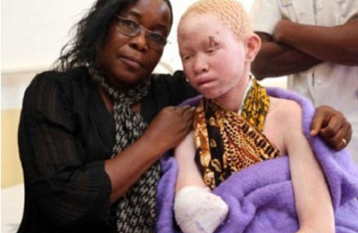 Canlı canlı parçalayıp satıyorlar! Böylesi görülmedi