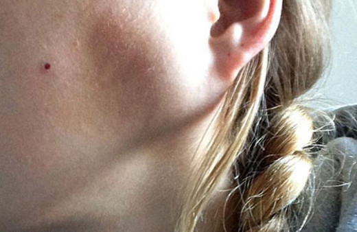 20'lik diş ağrısı sandı bakın ne çıktı?