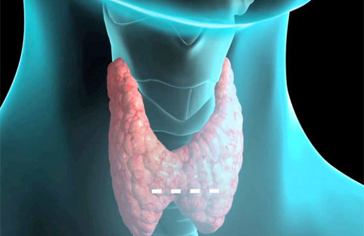 Tiroid bezi hastalığı nedir bu belirtilere dikkat!