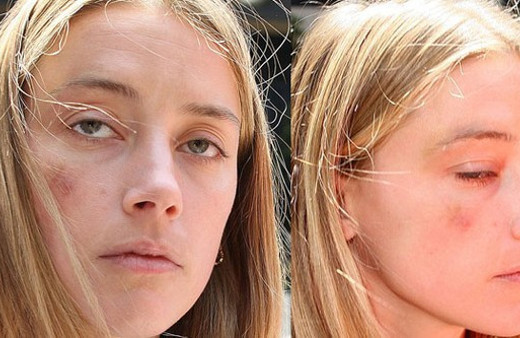 Ünlü oyuncudan inanılmaz olay! Eşinin yüzünü dağıttı