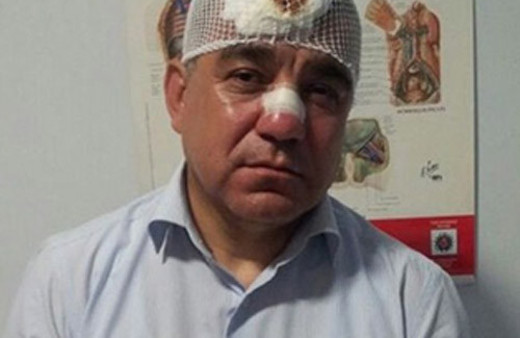 Vekilin burnunu kıran polisin cezası belli oldu