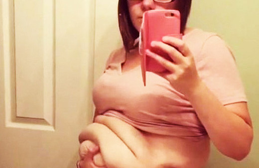 64 kilo verdi ama görenler inanmıyor bakın neden