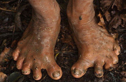 Film sahnesi değil tamamen gerçek! Bu ayakların sahibi...