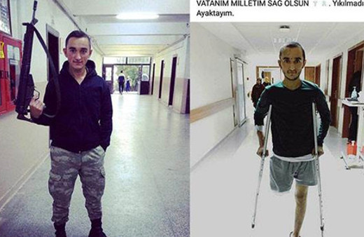 Kayseri gazisinin bacağı ikinci kez kesildi