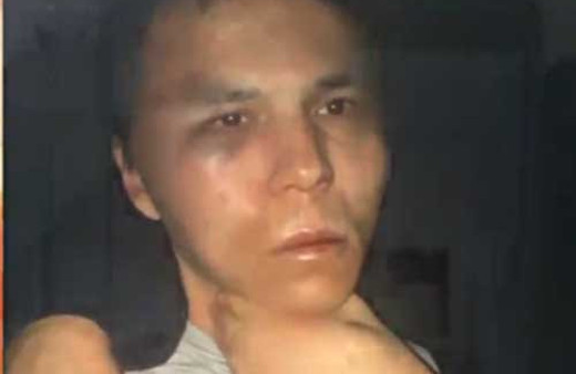 Reina saldırganı hastaneye götürüldü!